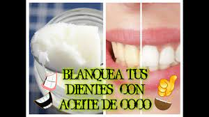 6 maneras sencillas de blanquear naturalmente los dientes en casa: Sonríe con confianza
